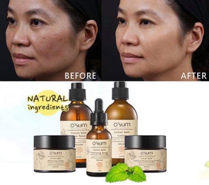 Bộ đôi organic từ Hàn Quốc đang khiến dân tình “phát sốt” nhờ khả năng dưỡng trắng, căng bóng, mờ nám đỉnh cao! - Ảnh 1.