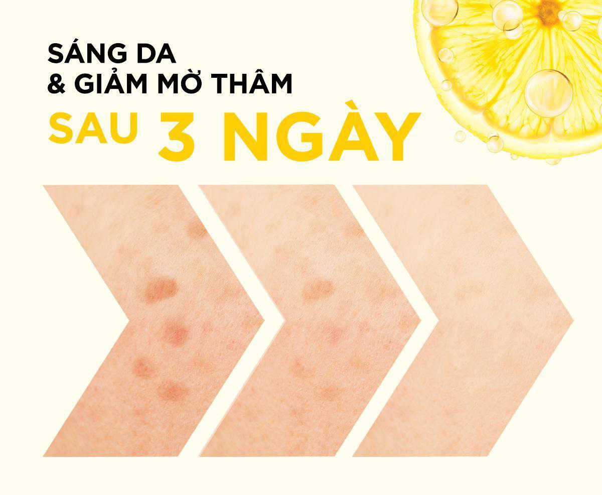 Serum Booster Vitamin C Garnier chứa combo vàng cho da sáng khỏe, có gì hay mà chuyên gia tâm đắc? - Ảnh 6.