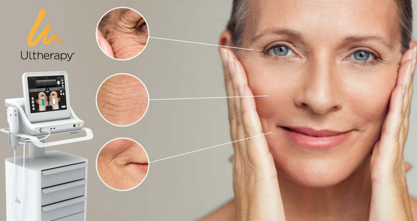 Đẩy lùi lão hóa sớm với công nghệ nâng cơ, căng da Ultherapy - Ảnh 2.
