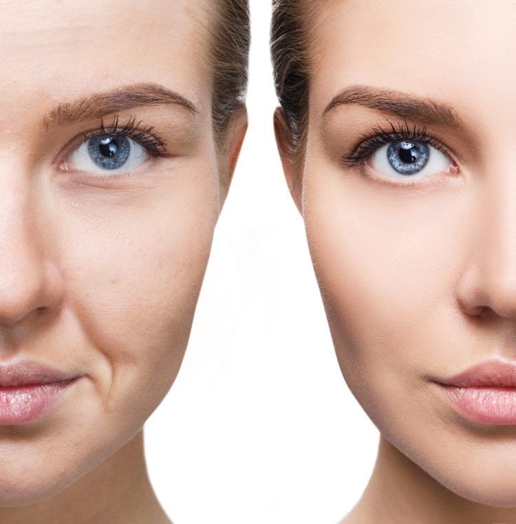 Cơ hội nhận 500 chai Fusion Retinol 1.0 khi tham gia sự kiện về Retinol tại Việt Nam - Ảnh 1.