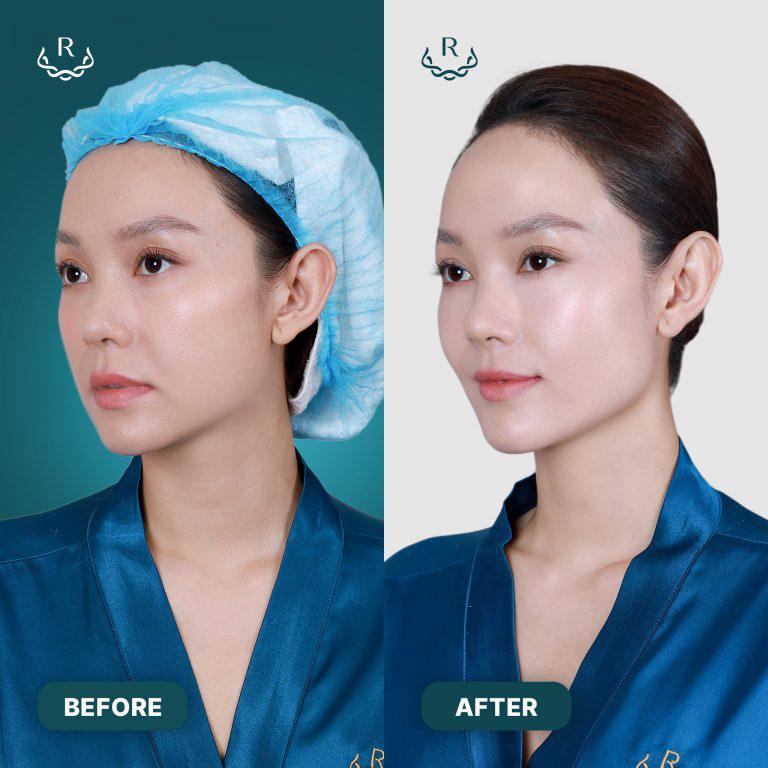 Hậu đám cưới, Minh Hằng tiết lộ lý do chi đến hàng tỷ đồng để chăm sóc sắc đẹp - Ảnh 5. Hậu đám cưới, Minh Hằng tiết lộ lý do chi đến hàng tỷ đồng để chăm sóc sắc đẹp - Ảnh 5.