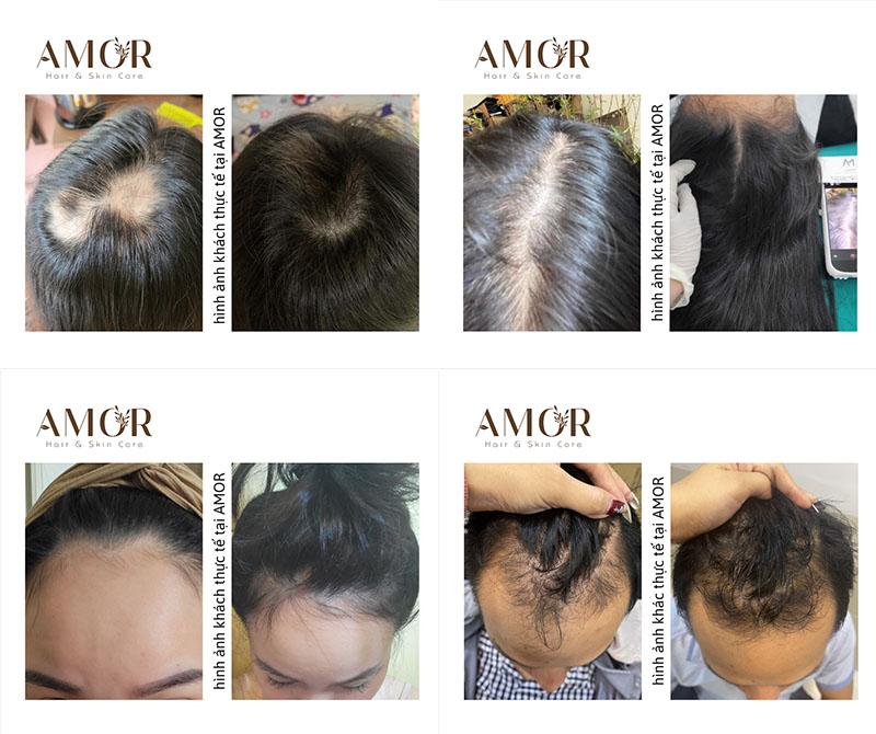 AMOR Thảo Mộc - Thương hiệu l&agrave;m đẹp bằng thảo mộc đ&aacute;ng lưu t&acirc;m tại TP. HCM - Ảnh 5.