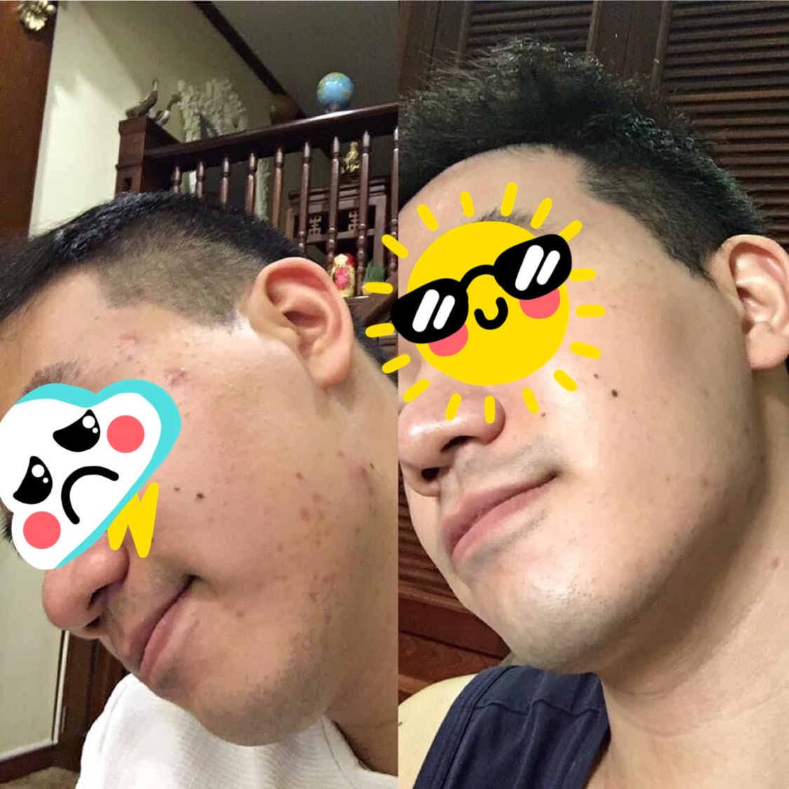 Skincare kiểu “tối giản” - Bôi càng ít, hiệu quả càng nhiều - Ảnh 3.