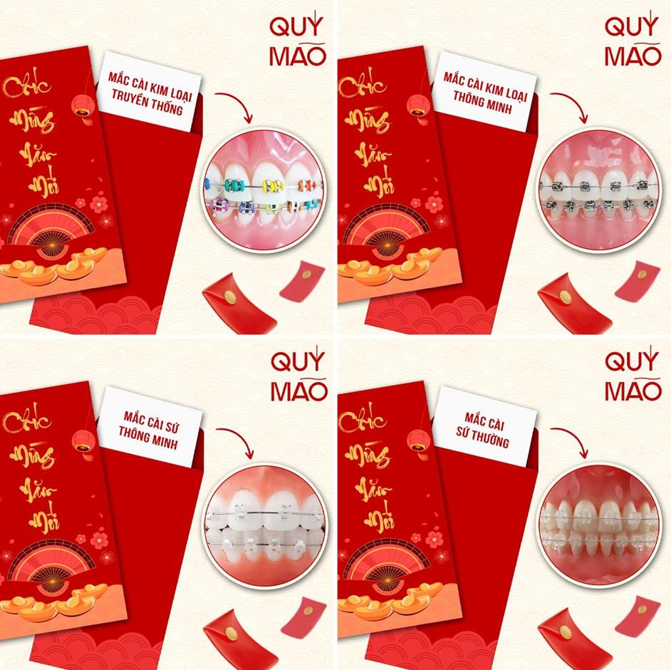 Ra Tết mà được mừng tuổi một bộ mắc cài thì khỏi chê - Ảnh 3.
