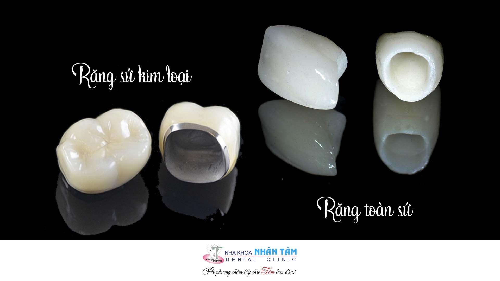 Chinh phục nụ cười hoàn mỹ với phương pháp trồng răng sứ - Ảnh 1.