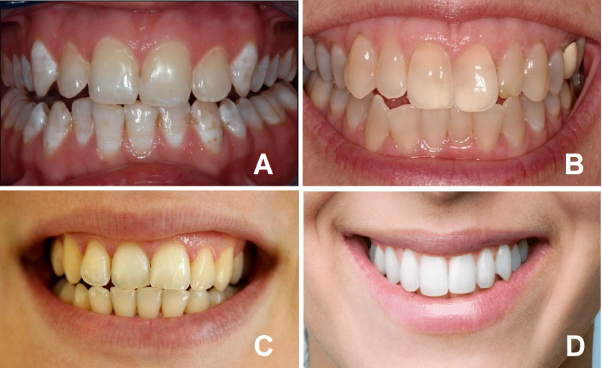 5 phút kiểm tra tình trạng răng của bạn - Ảnh 4.