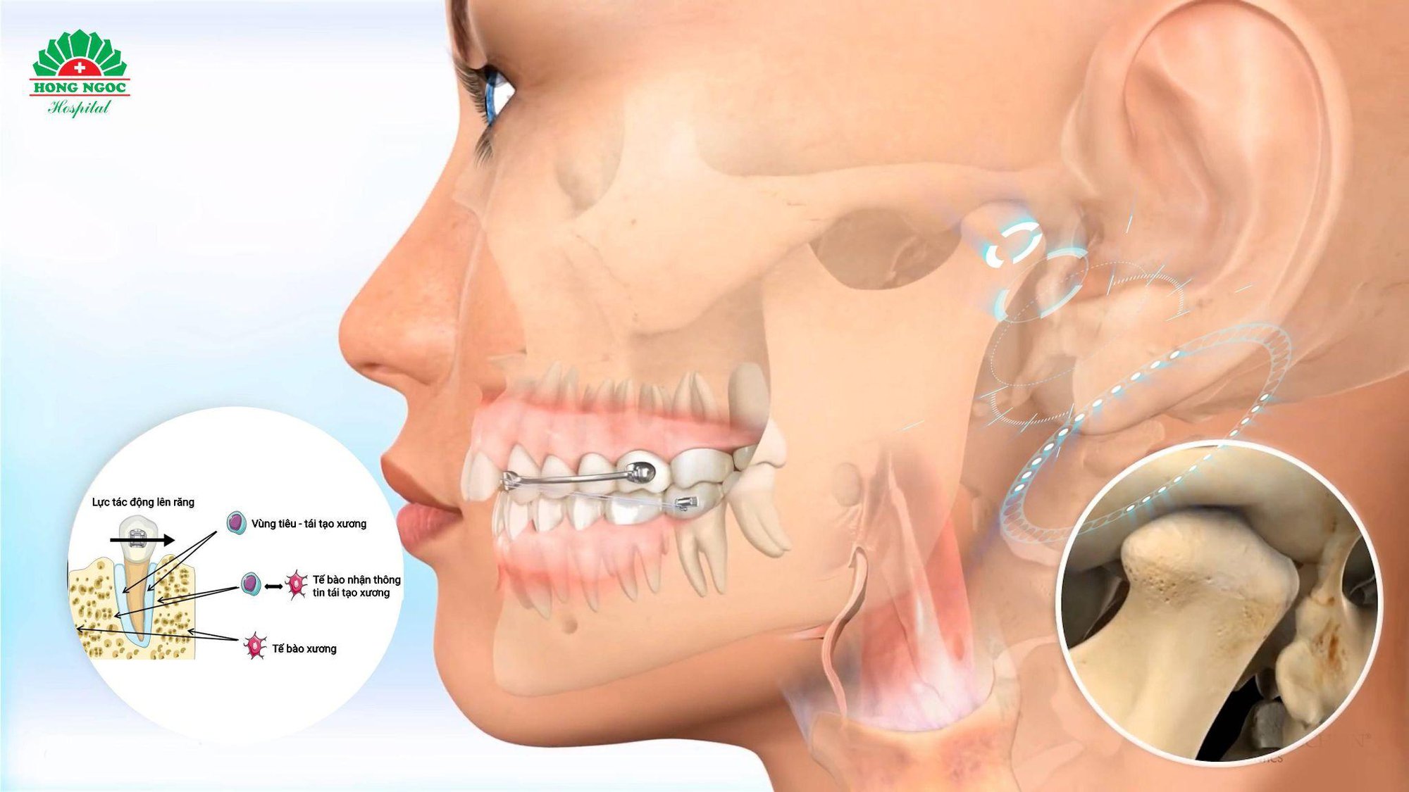Niềng răng sinh học: mang công nghệ vào niềng răng - Ảnh 1.