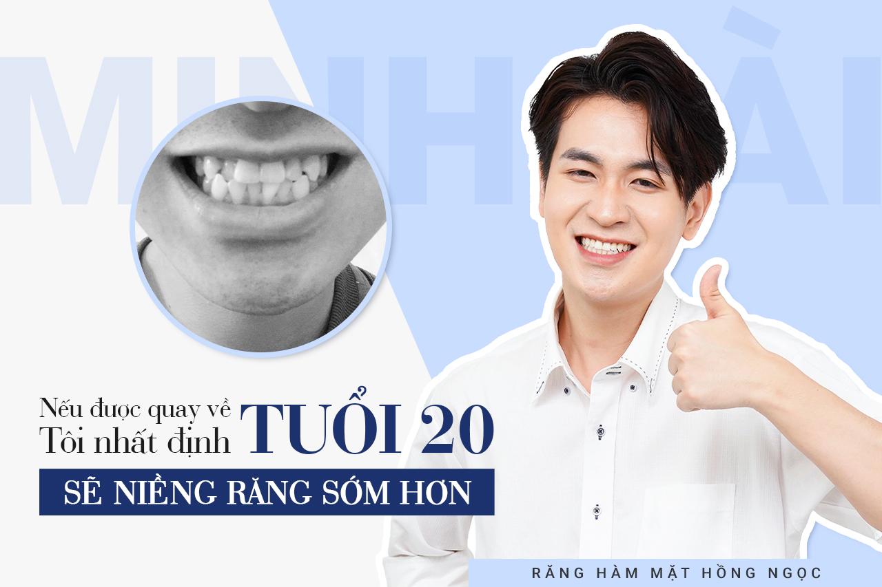 Niềng răng không chỉ vì một nụ cười đẹp, đôi khi đó còn là dấu ấn giúp thay đổi cuộc đời - Ảnh 1.