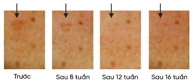 SkinMD Laboratories - thương hiệu thẩm mỹ Hàn Quốc được bảo chứng hiệu quả - Ảnh 2.