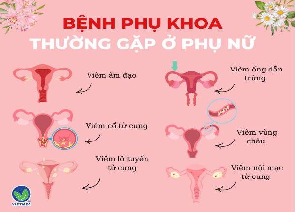 Viên đặt phụ khoa thảo dược VIETMEC có gì mà mọi chị em đều yêu thích? - Ảnh 1.