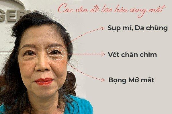 Bỏ túi 3 bí quyết giúp bạn ngày càng đẹp, nói không với lão hóa vùng mắt - Ảnh 1.