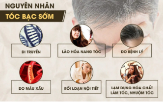 Tóc bạc sớm là biểu hiện của bệnh lý gì? - Ảnh 1.