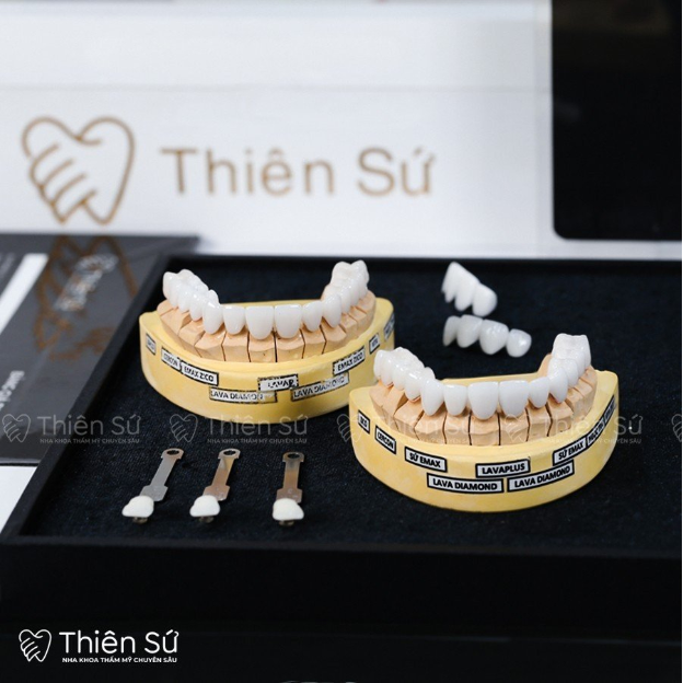 Nha khoa Thiên Sứ - Hành trình đến với nụ cười hoàn hảo và sự chăm sóc tận tâm - Ảnh 5.