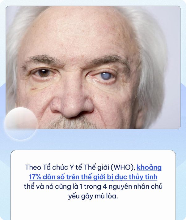 Căn bệnh cực phổ biến có thể dẫn đến mù lòa vĩnh viễn nhưng ít ai để tâm tới - Ảnh 2.