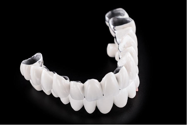 Răng sứ 800k có nên làm không? Phân tích chi tiết từ chuyên gia Nha khoa Bedental 4 Răng sứ 800k có nên làm không? Phân tích chi tiết từ chuyên gia Nha khoa Bedental