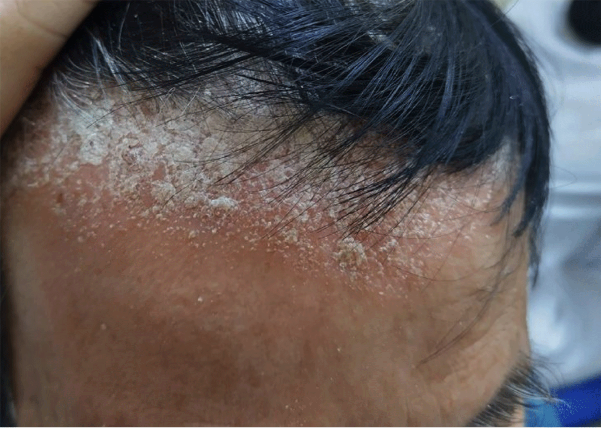 Thương hiệu dầu gội sạch gàu được tin dùng 10 năm qua - Ảnh 1. Thương hiệu dầu gội sạch gàu được tin dùng 10 năm qua - Ảnh 1.