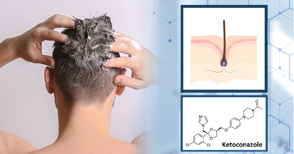 Thương hiệu dầu gội sạch gàu được tin dùng 10 năm qua - Ảnh 3. Thương hiệu dầu gội sạch gàu được tin dùng 10 năm qua - Ảnh 3.