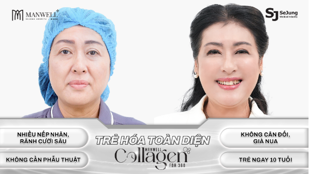 Nghệ sĩ Thanh Thủy: Thăng hạng nhan sắc tuổi trung niên vì chọn Manwell Collagen FDA 360 - Ảnh 2.