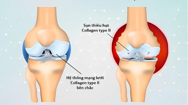 Vai trò của collagen đối với hệ cơ xương khớp - Ảnh 1.