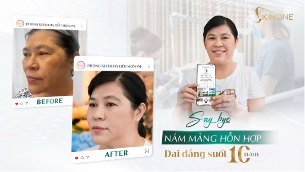 Phòng khám chuyên khoa da liễu SkinOne - Nơi lựa chọn của niềm tin - Ảnh 3.