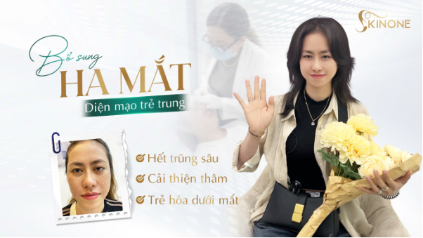 Phòng khám chuyên khoa da liễu SkinOne - Nơi lựa chọn của niềm tin - Ảnh 5.