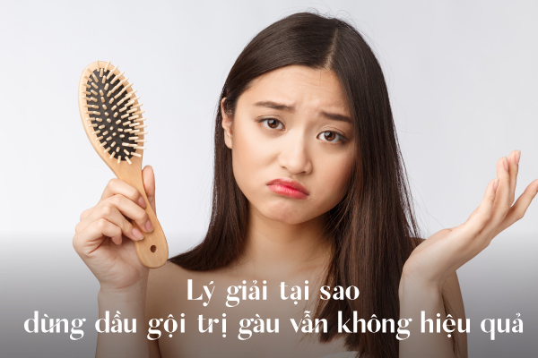 Dầu gội sạch gàu, sạch nấm hiệu quả mà không khô xơ tóc - Ảnh 3.