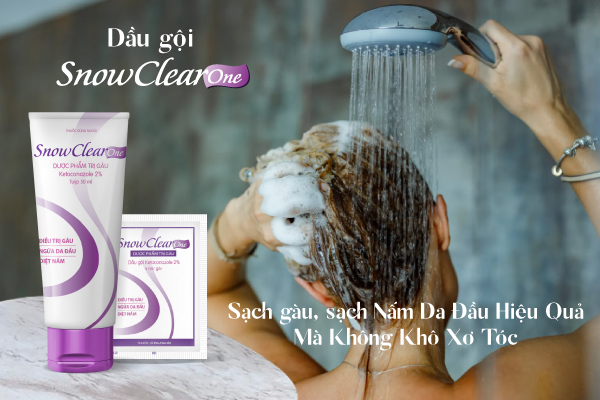 Dầu gội sạch gàu, sạch nấm hiệu quả mà không khô xơ tóc - Ảnh 4.