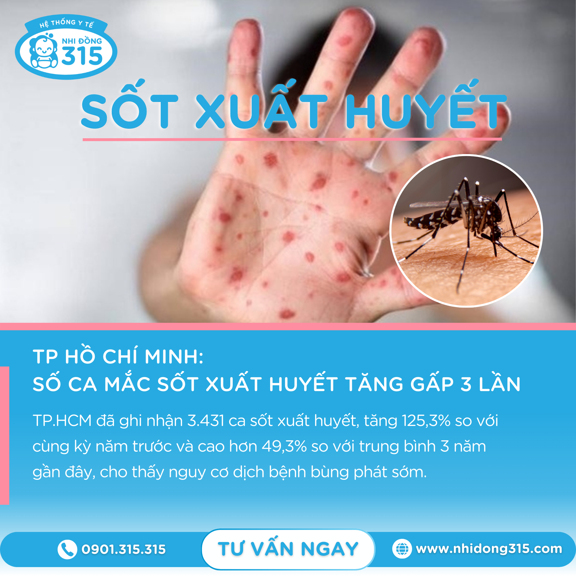 Mùa cao điểm sốt xuất huyết: ba mẹ cần biết đâu là dấu hiệu "cảnh báo" ở trẻ em- Ảnh 1. Mùa cao điểm sốt xuất huyết: ba mẹ cần biết đâu là dấu hiệu "cảnh báo" ở trẻ em- Ảnh 1.