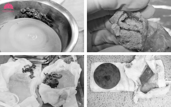 Sở hữu vòng 1 đẹp an toàn với xu hướng nâng ngực 4 không - Ảnh 1. Sở hữu vòng 1 đẹp an toàn với xu hướng nâng ngực 4 không - Ảnh 1.