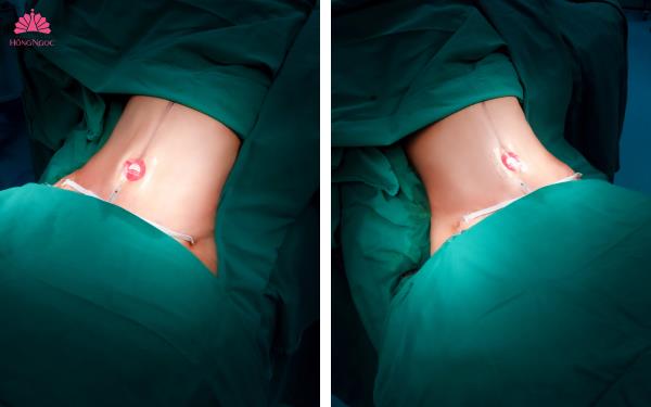 Điểm danh loạt dịch vụ thẩm mỹ “lên ngôi” mùa Tết 2026- Ảnh 2. Điểm danh loạt dịch vụ thẩm mỹ “lên ngôi” mùa Tết 2026- Ảnh 2.