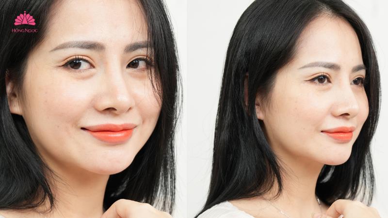 Điểm danh loạt dịch vụ thẩm mỹ “lên ngôi” mùa Tết 2026- Ảnh 3. Điểm danh loạt dịch vụ thẩm mỹ “lên ngôi” mùa Tết 2026- Ảnh 3.