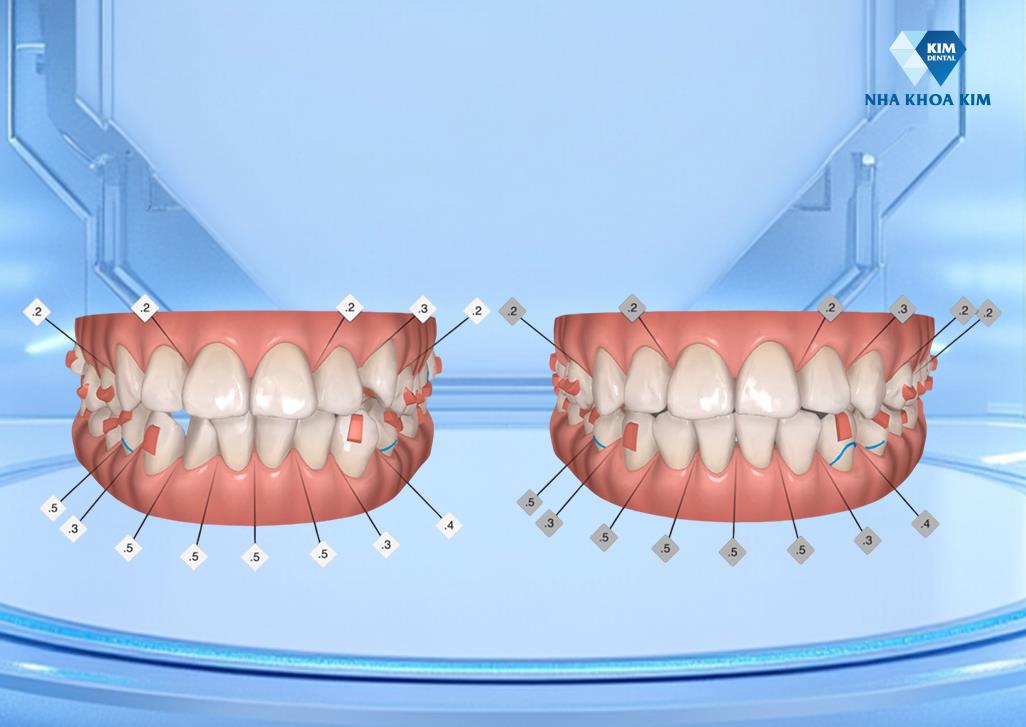 Nha khoa nổi tiếng nhờ ứng dụng công nghệ để nâng cao an toàn điều trị- Ảnh 2.