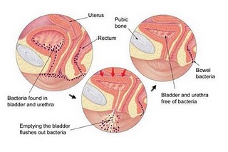 Tiểu buốt, tiểu dắt - Kh&aacute;ng sinh liệu c&oacute; đủ? 3