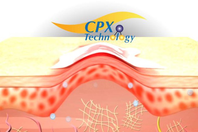 Sẹo lồi kh&ocirc;ng đ&aacute;ng lo như bạn tưởng 3