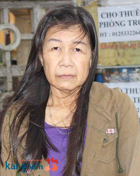 H&agrave;nh tr&igrave;nh lột x&aacute;c 2017: Đẹp l&agrave; cần thiết nhưng an to&agrave;n mới l&agrave; ti&ecirc;u ch&iacute; h&agrave;ng đầu - Ảnh 3.