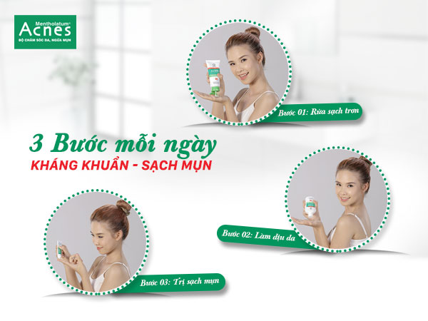 B&iacute; k&iacute;p chăm da sạch mụn, tỏa s&aacute;ng ng&agrave;y tựu trường - Ảnh 1.