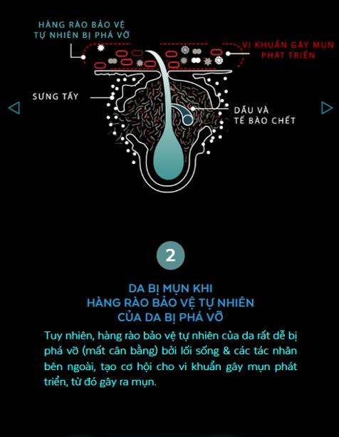 Chữa mãi mà mụn cứ tái phát, có thể vì bạn chưa biết đến lớp bảo vệ thần thánh này thôi - Ảnh 4.