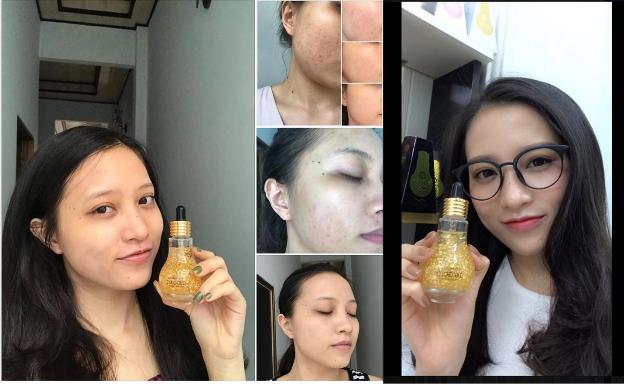 Ampoule – Tinh chất dưỡng da xứ Hàn giúp làn da thâm mụn xấu xí lột xác sau 30 ngày - Ảnh 2.