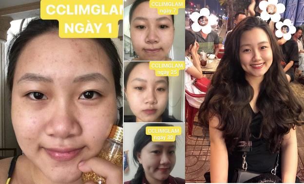 Ampoule – Tinh chất dưỡng da xứ Hàn giúp làn da thâm mụn xấu xí lột xác sau 30 ngày - Ảnh 3.