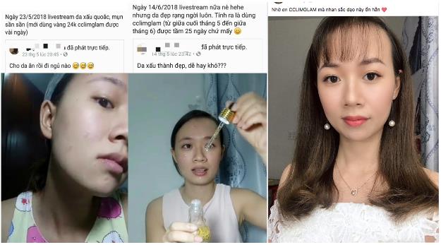 Ampoule – Tinh chất dưỡng da xứ Hàn giúp làn da thâm mụn xấu xí lột xác sau 30 ngày - Ảnh 4.