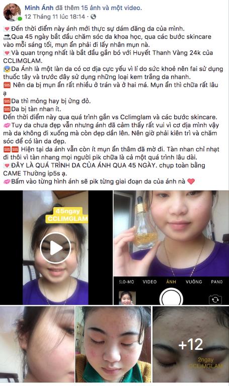 Ampoule – Tinh chất dưỡng da xứ Hàn giúp làn da thâm mụn xấu xí lột xác sau 30 ngày - Ảnh 5.