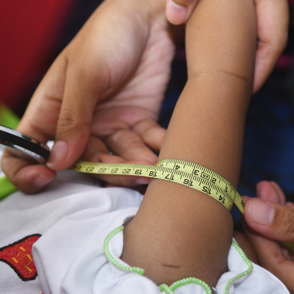 Suy dinh dưỡng vẫn là thách thức lớn với trẻ em Đông Nam Á - Ảnh 2.