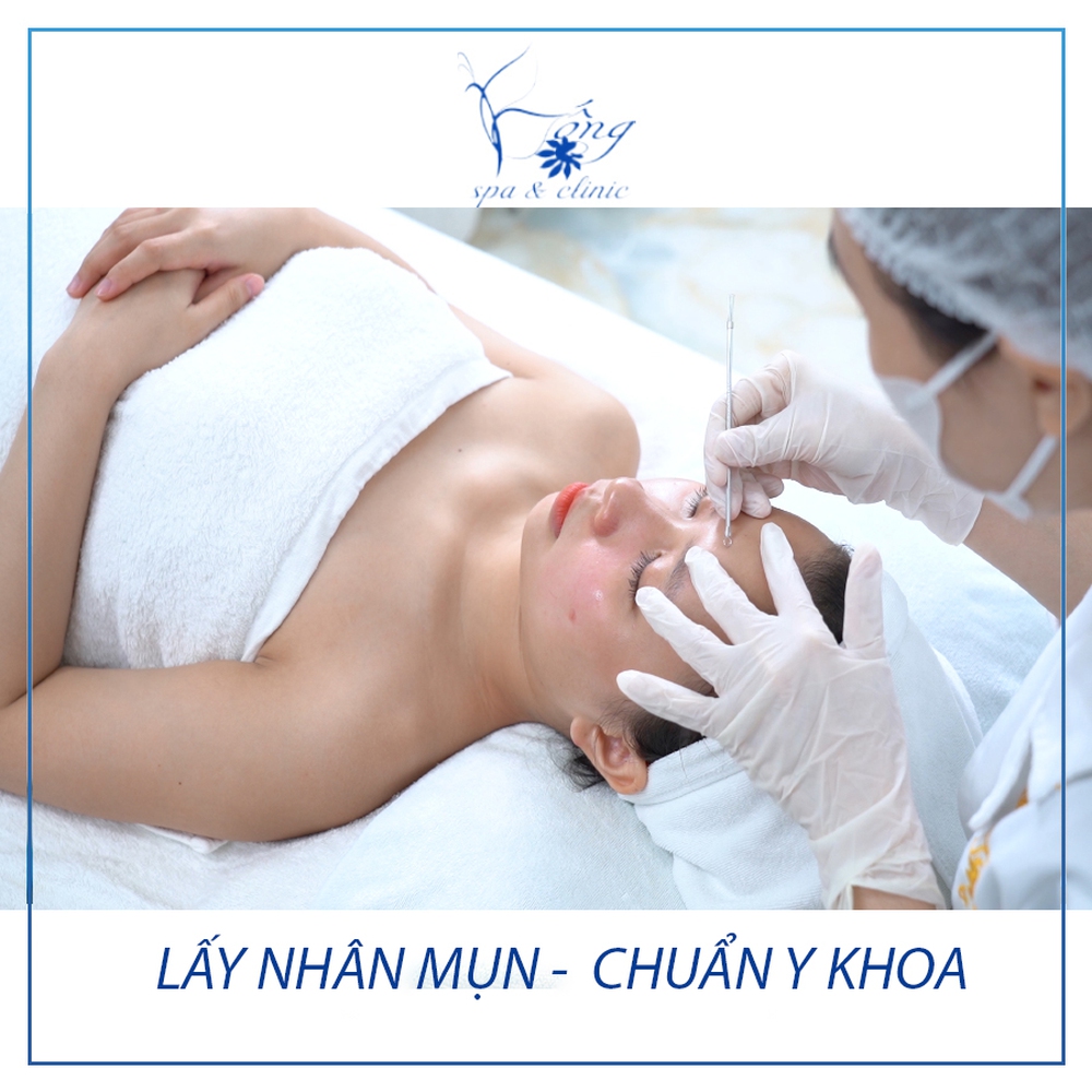 Spa trị mụn giá rẻ uy tín hiệu quả chỉ 199k ở TP HCM - Bống Spa - Ảnh 1.