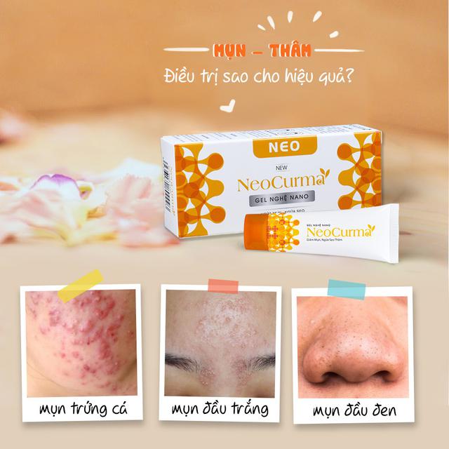 H&ocirc; biến da sạch mụn hết th&acirc;m chỉ nhờ một bảo bối nhỏ n&agrave;y đ&acirc;y! - Ảnh 6.
