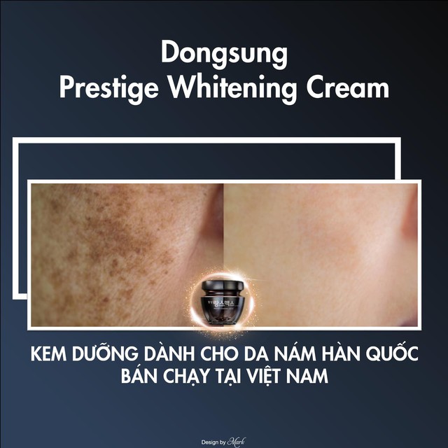 Chưa 30 mà đã có nám chi chít, thử ngay Dongsung Presitege Whitening Cream để thấy sự khác biệt - Ảnh 1.