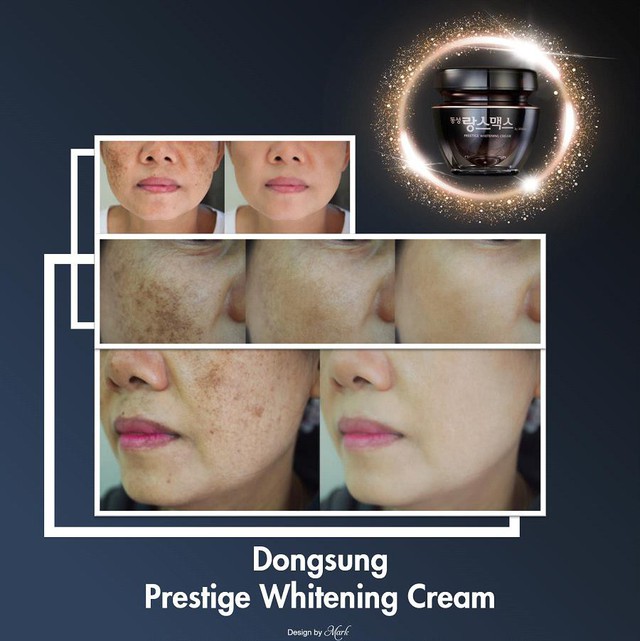 Chưa 30 mà đã có nám chi chít, thử ngay Dongsung Presitege Whitening Cream để thấy sự khác biệt - Ảnh 3.