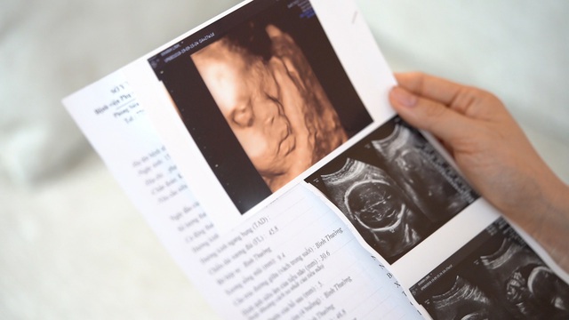Diễn viên Lan Phương, hotmom Huyền Tôm: “Thai giáo khi mang thai lần đầu giúp mình bớt áp lực, tâm lý ổn định, thai kỳ hạnh phúc” - Ảnh 2.