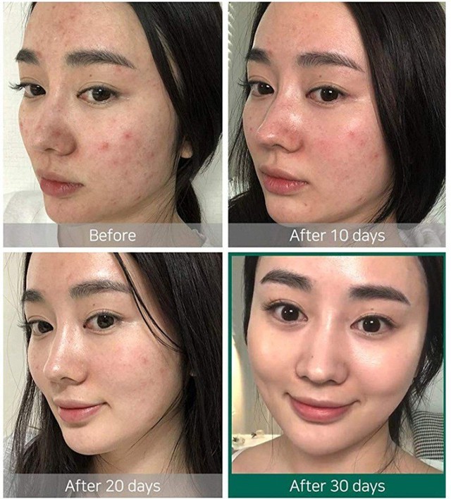 L&yacute; do thương hiệu mỹ phẩm H&agrave;n Quốc chiếm trọn tr&aacute;i tim bạn - Ảnh 1.