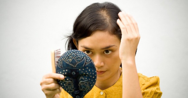 Những bí kíp đơn giản giúp mái tóc chắc khỏe, nhanh chóng thoát khỏi chứng rụng tóc nhiều - Ảnh 1.