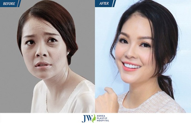 Đằng sau việc làm đẹp bằng tế bào gốc Multiᐩ, chuyên gia lên tiếng - Ảnh 5.